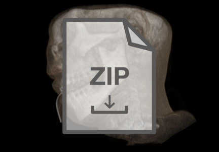ZipHttpReader Example
