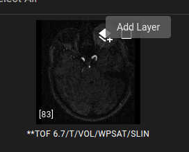 Add Layer