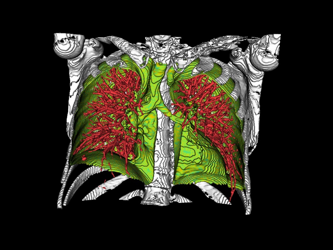 GeometryViewer Chest CT
