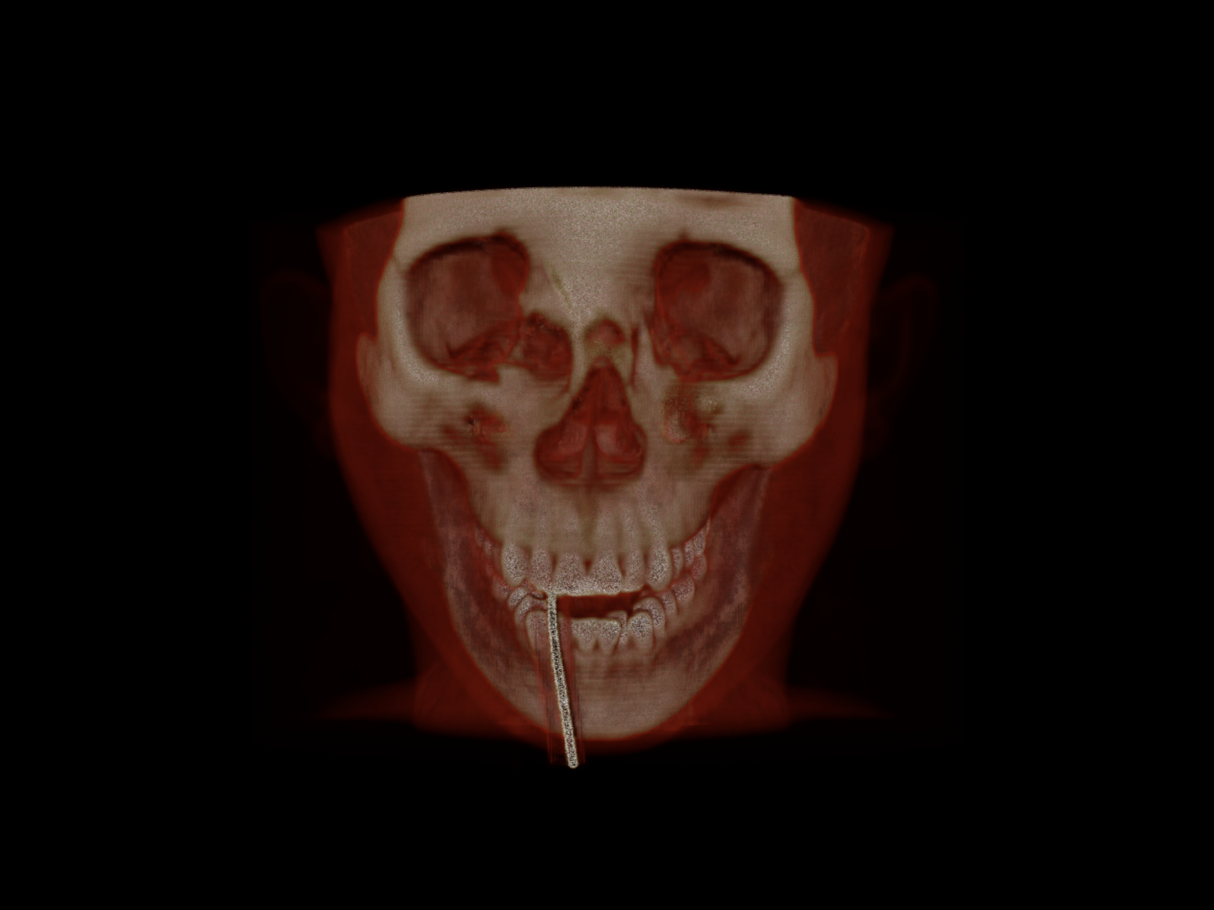 XR Volumetric Example