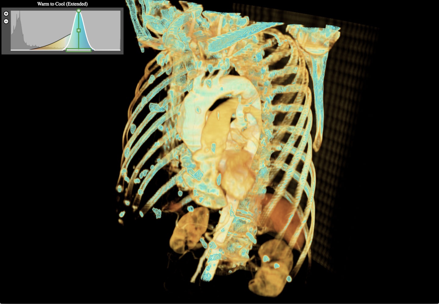 PiecewiseGaussianWidget