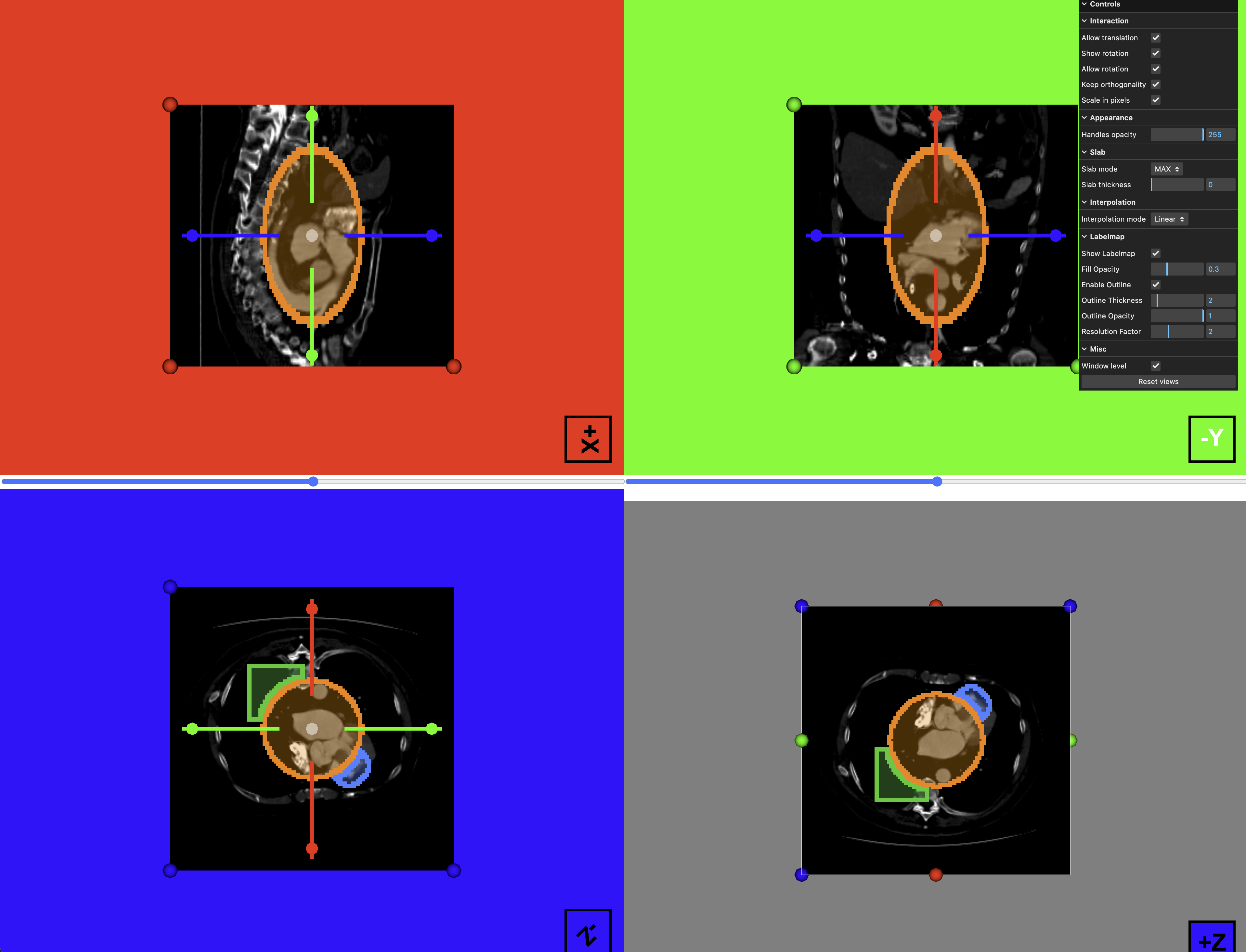 ResliceCursorWidgetLabelmap